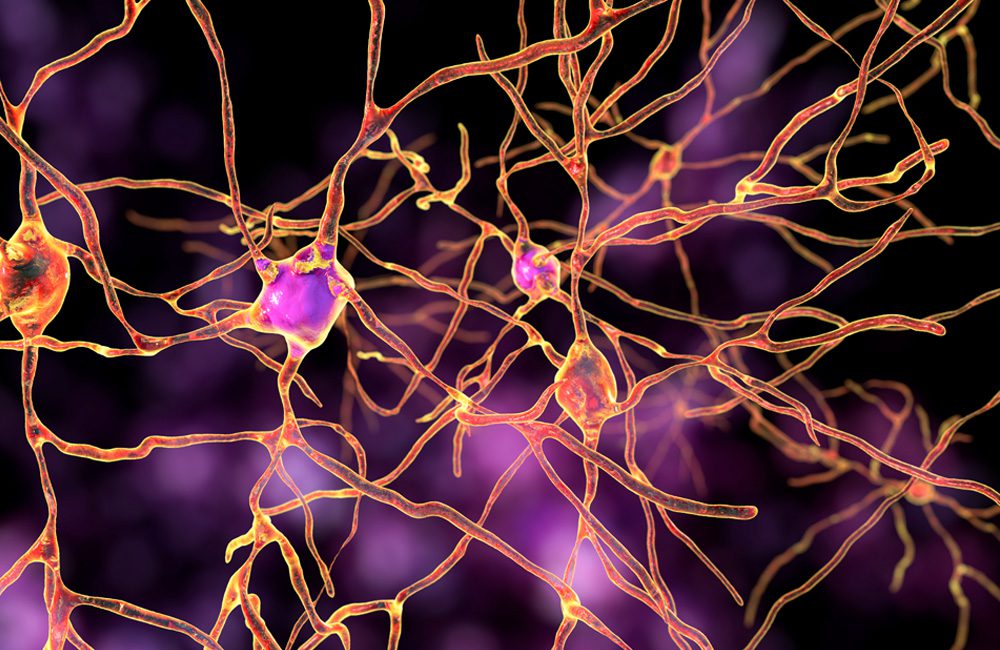 A New Treatment For Huntington's Disease ©Kateryna Kon / Shutterstock.com