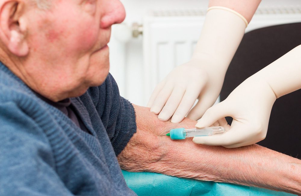 Blood Tests For Alzheimer's ©Barabasa / Shutterstock.com