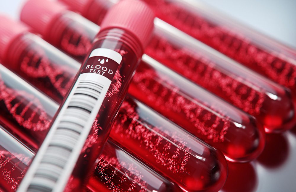 Blood Tests For Cancer ©Connect world / Shutterstock.com